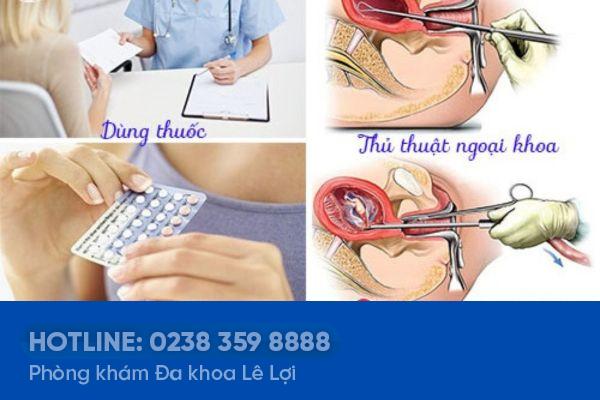 Các biện pháp phá thai an toàn hiện nay là gì?