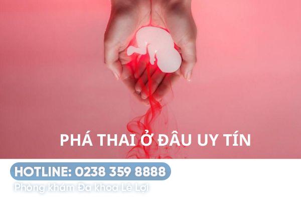 Bệnh viện phá thai an toàn uy tín tại Vinh