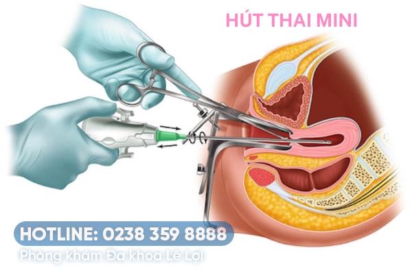 hut-thai-khong-dau